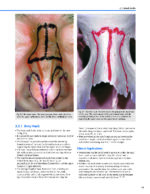 Dallas Rhinoplasty Nasal Surgery by the Masters (Fourth Edition) 2024 - Image 12