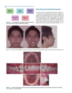 Dentofacial Orthopedics in the Growing Child 2023 - Image 7