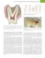 Sturdevant’s ART and SCIENCE of OPERATIVE DENTISTRY 2026 + Supplemental Online Chapters - Image 10