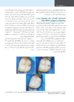 علم و هنر در دندانپزشکی ترمیمی 2026  جلد دوم - Image 6