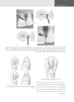 علم و هنر در دندانپزشکی ترمیمی 2026  جلد دوم - Image 16