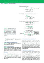 Bailey & Love’s Essential Operations in Oral and Maxillofacial Surgery 2024 - Image 10
