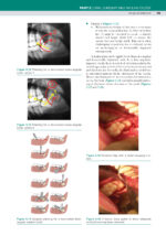 Bailey & Love’s Essential Operations in Oral and Maxillofacial Surgery 2024 - Image 2