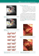 Bailey & Love’s Essential Operations in Oral and Maxillofacial Surgery 2024 - Image 2