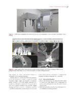 Digital Dentistry: A Step-by- Step Guide and Case Atlas 2022 - Image 7