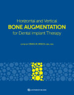Horizontal and Vertical BONE AUGMENTATION for Dental Implant Therapy 2024 - Image 3