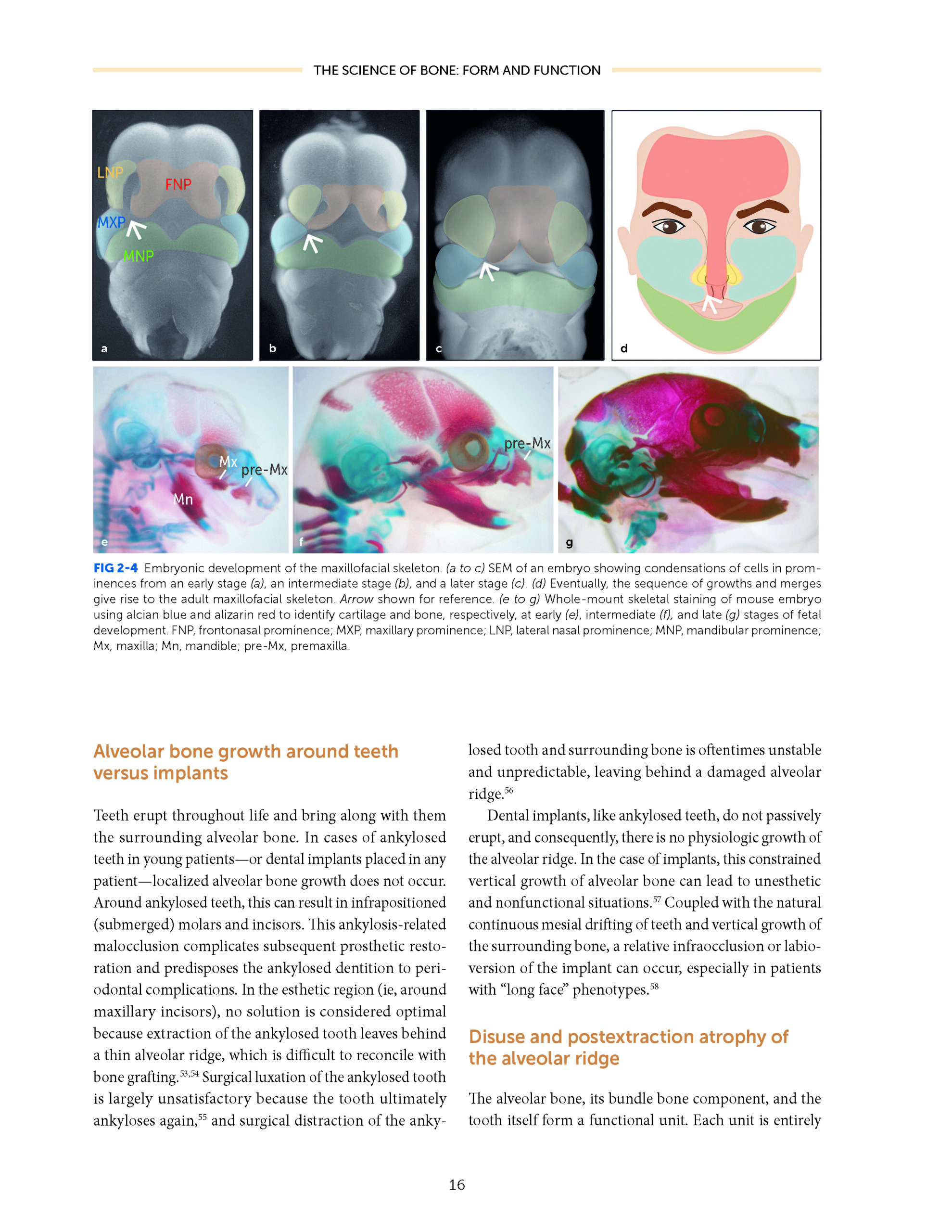 Horizontal and Vertical BONE AUGMENTATION for Dental Implant Therapy 2024 - Image 2