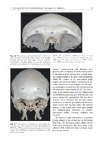 Surgery in and around the Orbit 2023 - Image 2