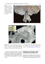 Surgery in and around the Orbit 2023 - Image 8