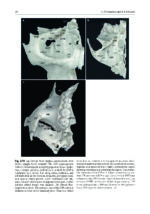 Surgery in and around the Orbit 2023 - Image 7