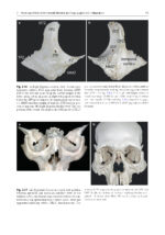 Surgery in and around the Orbit 2023 - Image 4