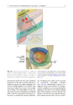 Surgery in and around the Orbit 2023 - Image 5