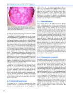 Oral Cancer: Evaluation, Therapy, and Rehabilitation 2020 - Image 5