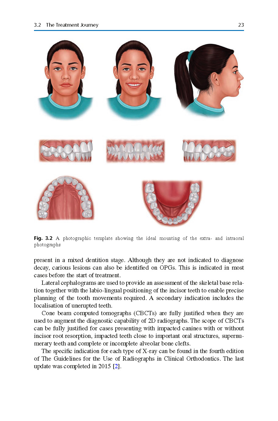 38 Pages from Aligner_Systems_in_Invisible_Orthodontics_Basic_Concepts_and_Clinical-2_Page_37 Aligner Systems in Invisible Orthodontics: Basic Concepts and Clinical Management 2024 - Image 8