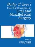 Bailey & Love’s Essential Operations in Oral and Maxillofacial Surgery 2024