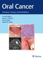 Oral Cancer: Evaluation, Therapy, and Rehabilitation 2020