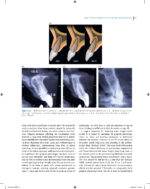 Immediate Dental Implants for Esthetic and Premolar Sites 2025 - Image 9