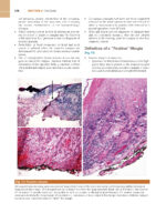 ATLAS OF HEAD AND NECK PATHOLOGY 2024 (FOURTH EDITION) -TWO VOL - Image 6