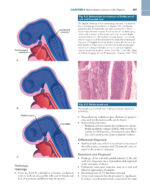 ATLAS OF HEAD AND NECK PATHOLOGY 2024 (FOURTH EDITION) -TWO VOL - Image 8