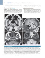 ATLAS OF HEAD AND NECK PATHOLOGY 2024 (FOURTH EDITION) -TWO VOL - Image 4