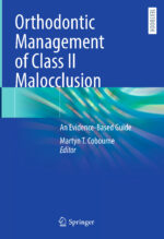 Orthodontic Management of Class II Malocclusion: An Evidence-Based Guide 2024 - Image 2