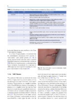 Orthodontic Management of Class II Malocclusion: An Evidence-Based Guide 2024 - Image 4