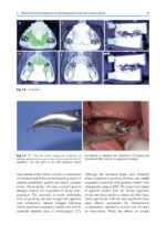 Orthodontic Management of Class II Malocclusion: An Evidence-Based Guide 2024 - Image 7