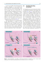 Orthodontic Management of Class II Malocclusion: An Evidence-Based Guide 2024 - Image 9