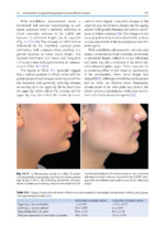 Orthodontic Management of Class II Malocclusion: An Evidence-Based Guide 2024 - Image 16