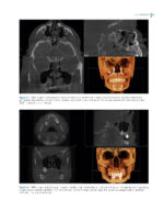 Clinical Applications of Digital Dental Technology 2023 (Second Edition) - Image 4