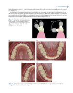 Clinical Applications of Digital Dental Technology 2023 (Second Edition) - Image 5