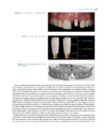 Clinical Applications of Digital Dental Technology 2023 (Second Edition) - Image 10