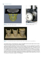 Clinical Applications of Digital Dental Technology 2023 (Second Edition) - Image 9