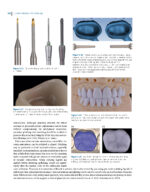 Clinical Applications of Digital Dental Technology 2023 (Second Edition) - Image 7
