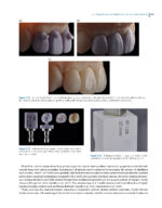 Clinical Applications of Digital Dental Technology 2023 (Second Edition) - Image 6