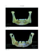 THE MANDIBLE: An Atlas Osteological and Radiological Anatomy 2022 - Image 6