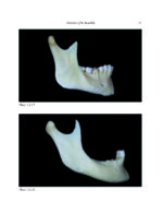 THE MANDIBLE: An Atlas Osteological and Radiological Anatomy 2022 - Image 5
