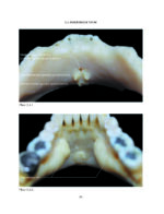 THE MANDIBLE: An Atlas Osteological and Radiological Anatomy 2022 - Image 4