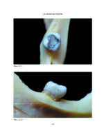 THE MANDIBLE: An Atlas Osteological and Radiological Anatomy 2022 - Image 13