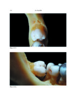 THE MANDIBLE: An Atlas Osteological and Radiological Anatomy 2022 - Image 12