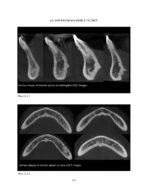 THE MANDIBLE: An Atlas Osteological and Radiological Anatomy 2022 - Image 11