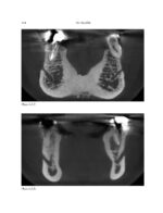 THE MANDIBLE: An Atlas Osteological and Radiological Anatomy 2022 - Image 10