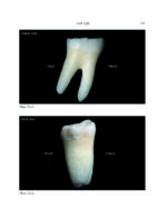 THE MANDIBLE: An Atlas Osteological and Radiological Anatomy 2022 - Image 8