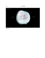 THE MANDIBLE: An Atlas Osteological and Radiological Anatomy 2022 - Image 7