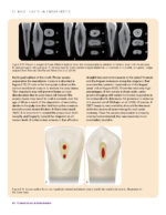 Clinical Cases in Endodontics 2018 - Image 6