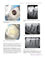 Clinical Cases in Endodontics 2018 - Image 3