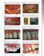 Periodontology at a Glance 2024 - Image 5