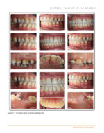 Clinical Cases in Periodontics 2022 (2nd Edition) - Image 2
