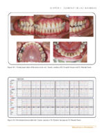 Clinical Cases in Periodontics 2022 (2nd Edition) - Image 11