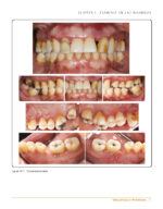 Clinical Cases in Periodontics 2022 (2nd Edition) - Image 3